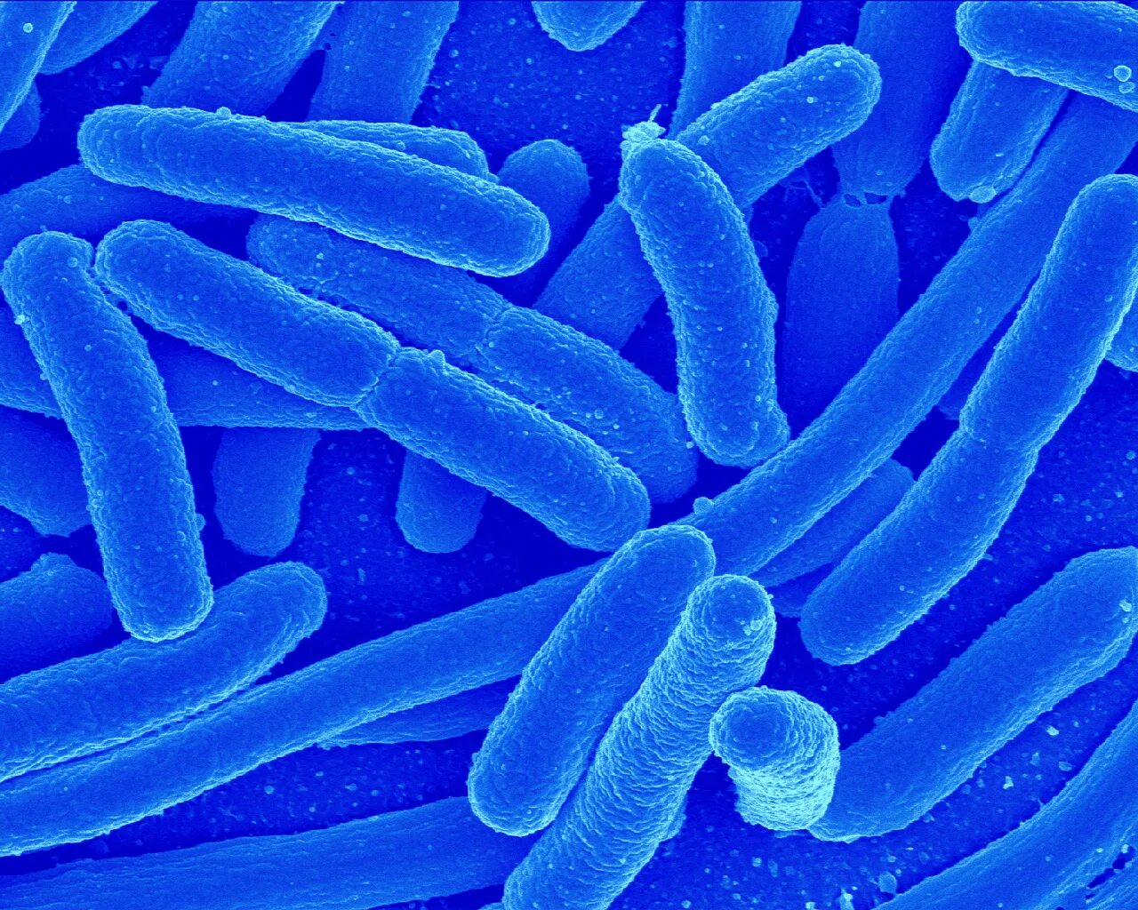 Почему бактерии живые. Кишечная палочка Escherichia coli. Кишечная палочка микрофотография. Escherichia coli микрофотография. Бактерии рода Escherichia coli.