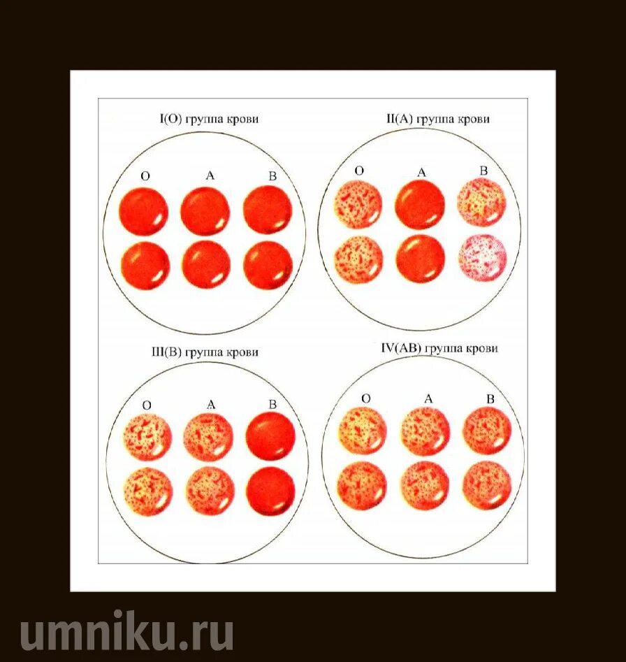 Тест на резус фактор. Резус фактора цоликлонами. Резус фактор методом моноклональных антител. Определение резус фактора методом цоликлонов. Клинические методы определения групп крови и резус-фактора..