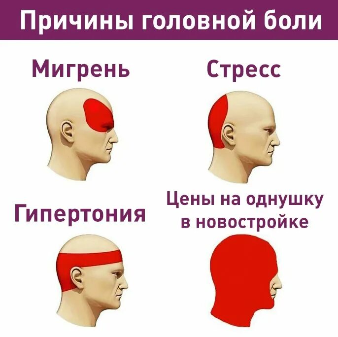 Каждый день болит голова что делать. Причины головной боли. Головная боль в затылке. Головная боль локализация. Боли в голове причины.