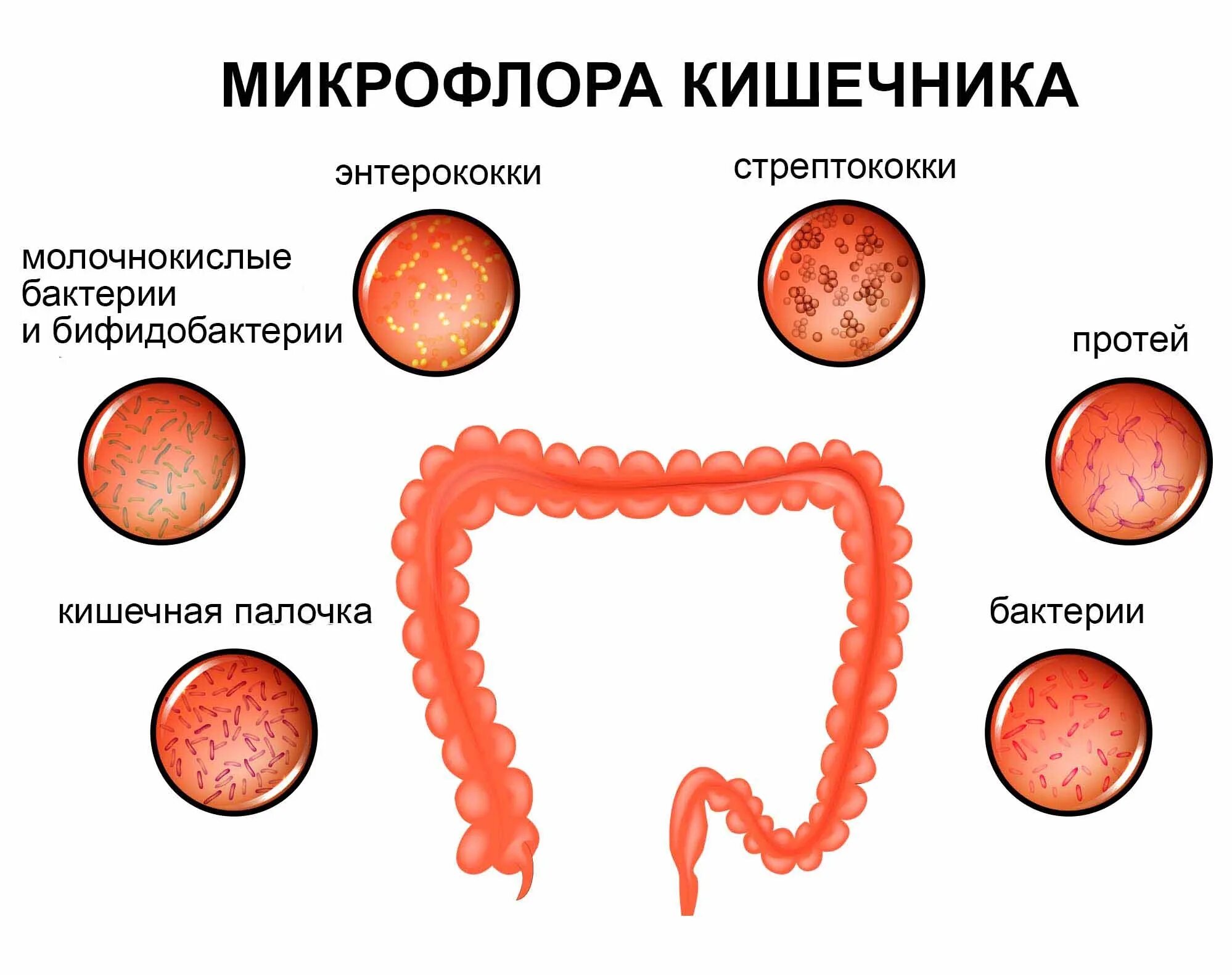 Дисбактериоз кишечника картинки. Болезнь крона кишечник. Энтерит кишечника симптомы. Кишечный дисбактериоз проявления. Воспаление тонкого кишечника препараты.
