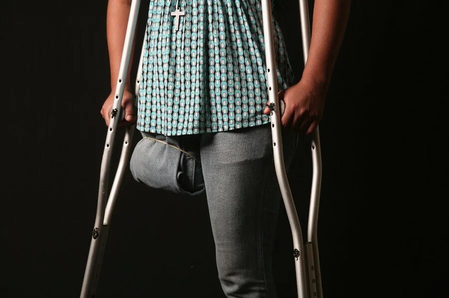 Костыли для инвалидов с одной ногой. Инвалид на костылях. Прогулка на костылях. Парень на костылях.