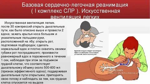 Соотношение компрессия вентиляция