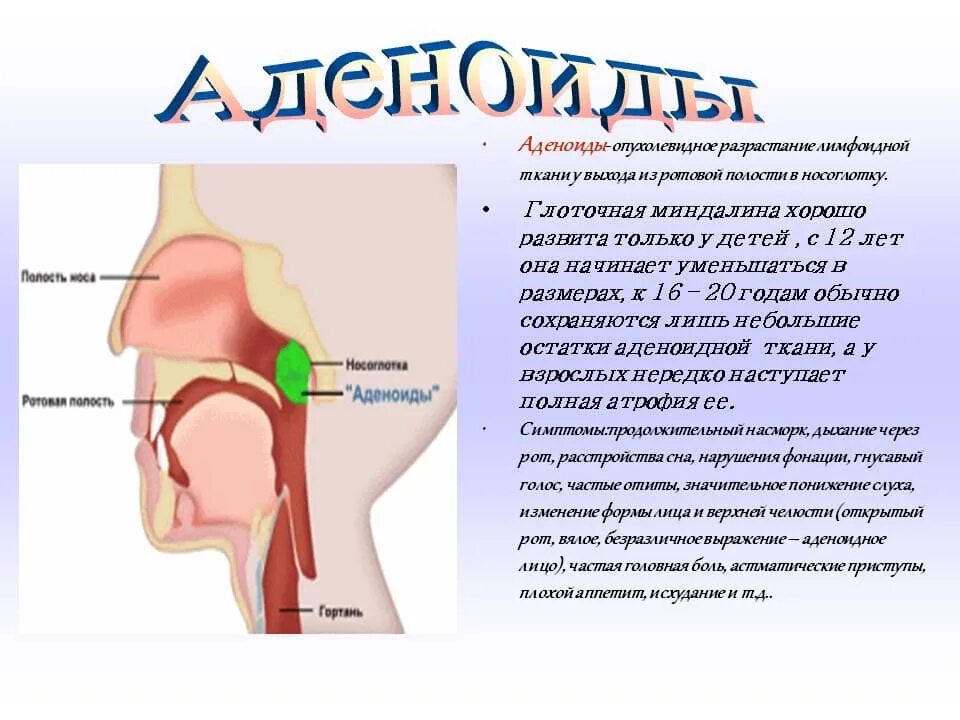 Аденоиды признаки. Глоточная миндалина аденоиды. Воспаление носоглотки.