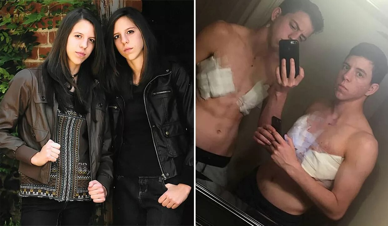 Братья которые стали сестрами. Транс мужчина. Сёстры джек и джейс. Два брата тарасовых. Лана и лилли вачовски.