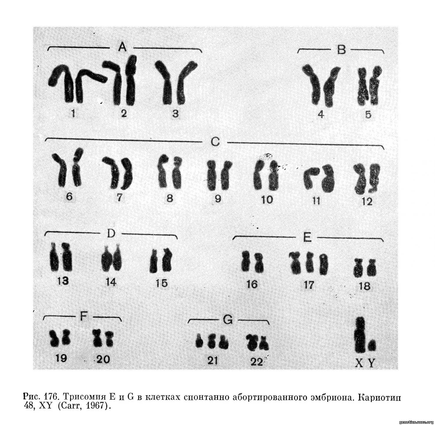 Полиплоидия кариотип. Триплоидный набор хромосом. Полиплоидия триплоидия. Триплоидный хромосомный набор. Триплоидные структуры.