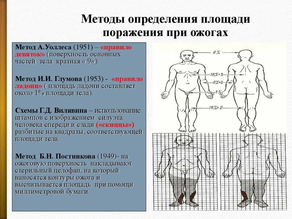 Методы определения площади ожогов. Схема определения площади ожогов. Методы определения площади поражения при ожогах. Площадь поражения при ожогах. Пл тела