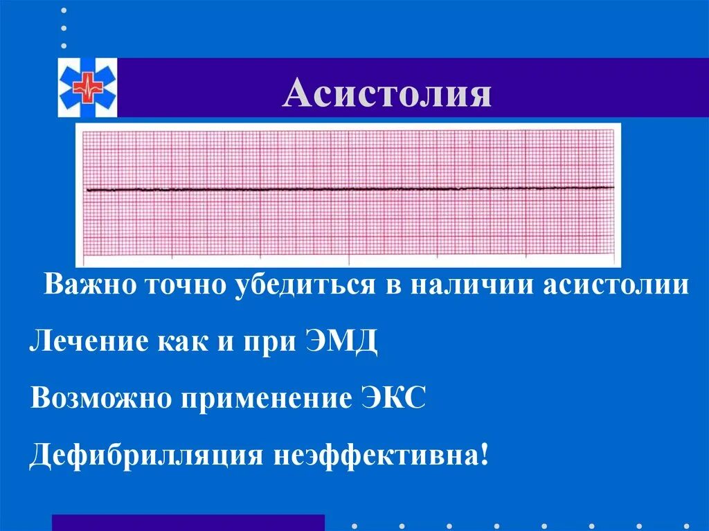 Асистолия сердца это. Асистолия. Асистолия сердца. Асистолия на кардиограмме. Клинический признак асистолии.