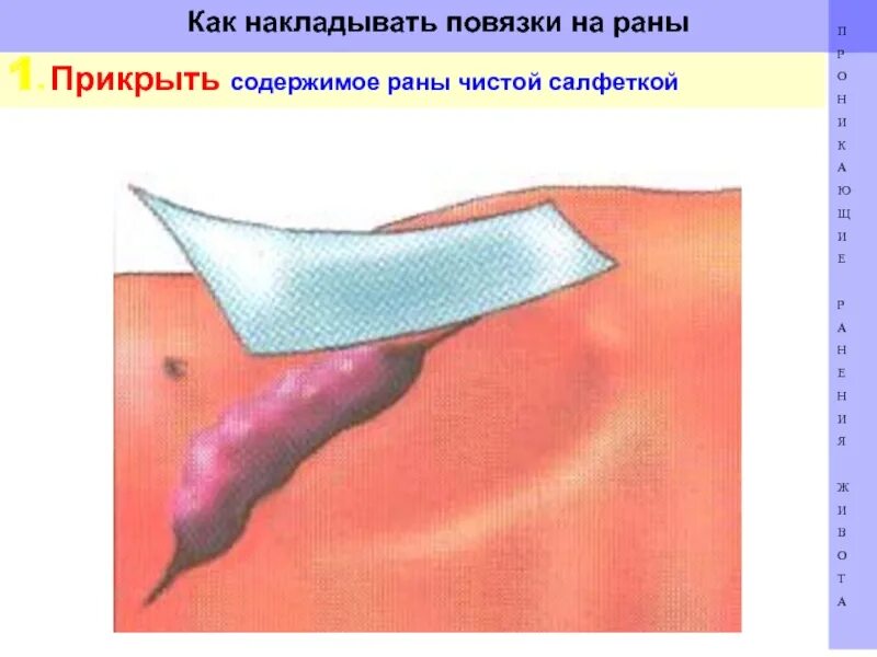 Туалет раны и первичная хирургическая обработка пхо раны. Гнойное воспаление кожи. Операция вскрытия флегмоны глазницы. Обработка гнойной раны алгоритм. Флегмона надгрудинного межапоневротического пространства.