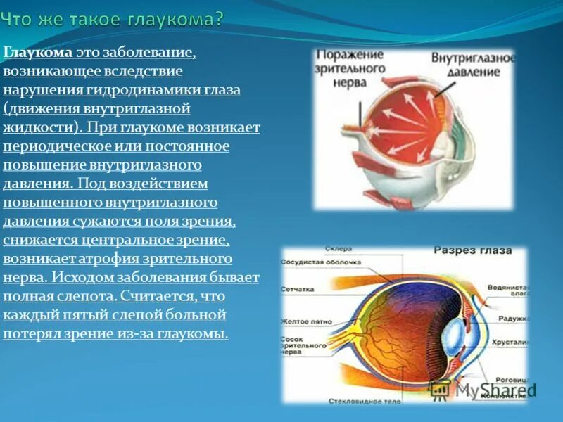 Что делать при глаукоме глаза. Повышение внутриглазного давления (глаукома).. Глаукома внутриглазное давление при глаукоме. При глаукоме глазное яблоко при надавливании:.