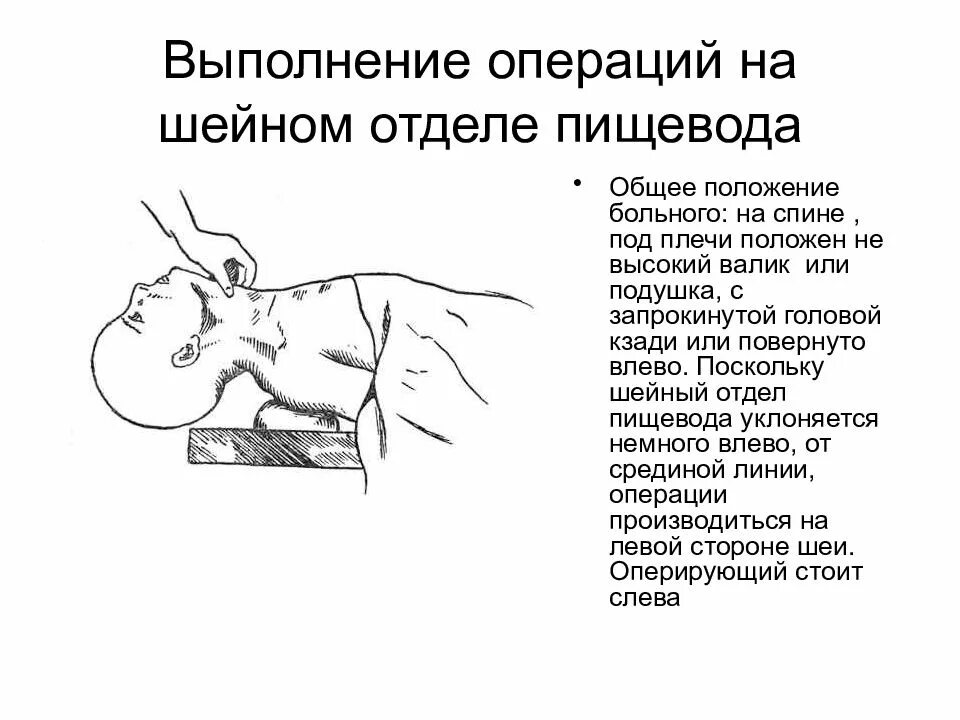 Операции на пищеводе. Оперативное вмешательство при повреждении шейного отдела пищевода. Операции на шейном отделе пищевода топографическая анатомия. Ранения шейного отдела пищевода.