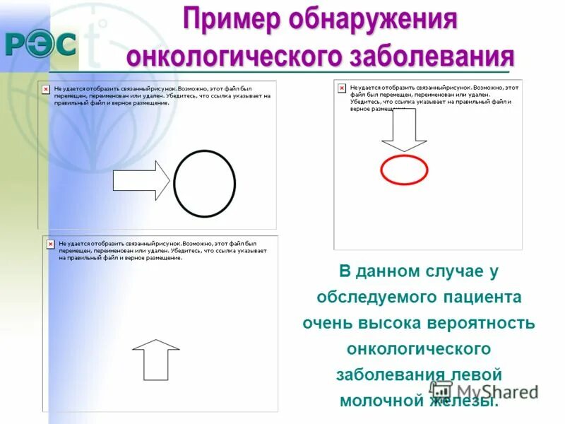 Обнаружение примеры. Обнаружение примеры. Выявленные риски примеры. Принцип работы сцинтилляционного детектора. Примеры обнаружения.