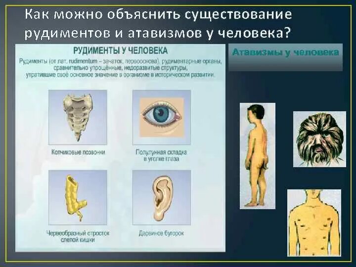 Каким образом рудименты и атавизмы доказывают. Атавизмы и рудименты человека. Наличие у человека рудиментов и атавизмов. Рудименты и атавизмы человека таблица. Рудименты и атавизмы примеры.