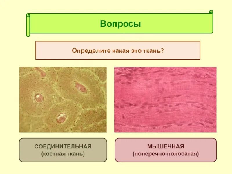 Костная соединительная ткань. Скелетная соединительная ткань. Костная ткань соединительная ткань. Костаная соединительная тканбь.