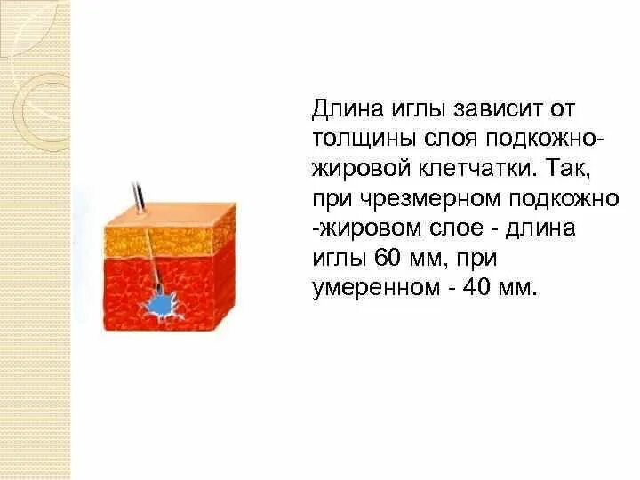 Строение машинной иглы. Виды швейных игл для шитья. Иглы машинные бывают. Таблица виды шприцов и игл. Иглы и нитки для швейных машин таблица.