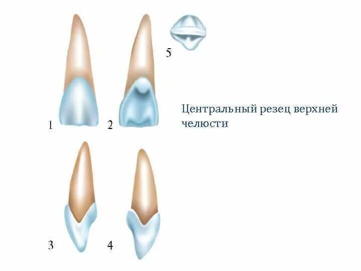 Зуб боковой резец. Медиальный резец верхней челюсти анатомия. Медиальный резец верхней челюсти форма. Латеральный резец верхней челюсти анатомия. Верхний медиальный (Центральный) резец.