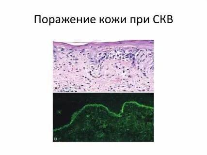 35 поражение
