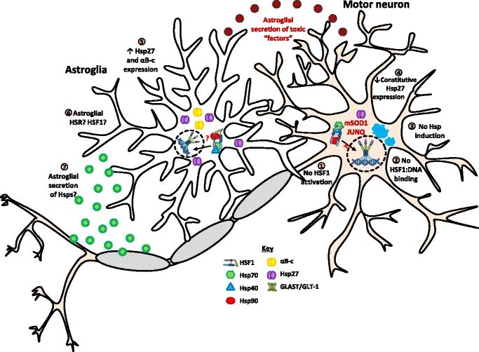 Нейровоспаление мозга. Astroglia. Motor neuron disease. Нейровоспаление у детей.