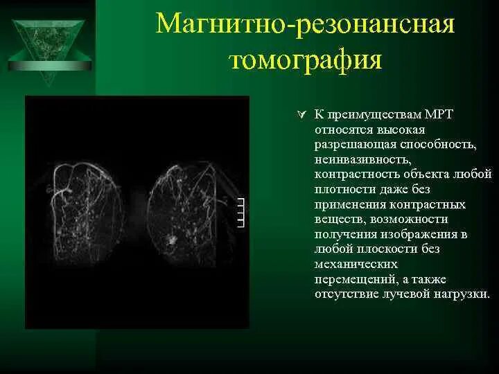 Делают ли кт молочных желез. Магнитно-резонансная томография молочных желез. фиброаденома молочной железы на мрт с контрастом. опухоль молочной железы мрт. мрт молочных желез норма.