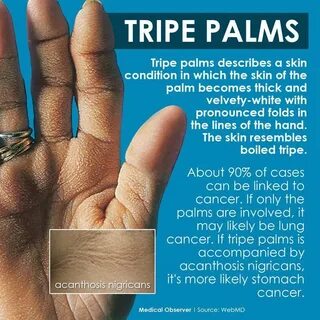 Palm перевод