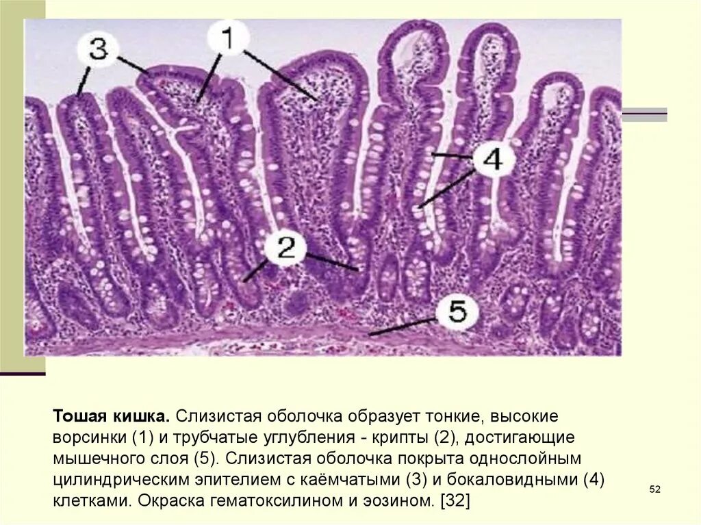 Каемчатый эпителий гистология. Однослойный цилиндрический эпителий кишки. Однослойный призматический каемчатый эпителий кишки. Однослойный призматический каемчатый эпителий выстилает. Наличие ворсинок в слизистой оболочке