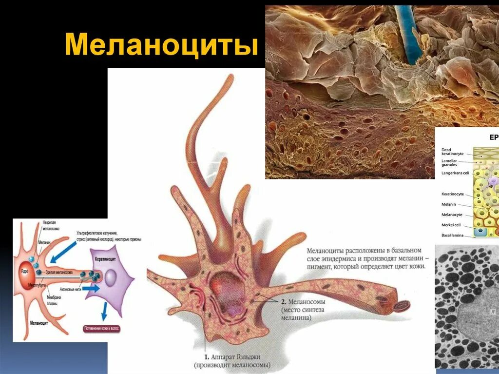 В собственно коже отсутствует пигмент. Меланоциты строение гистология. Меланосомы и меланоциты. Меланоциты клетки эпидермиса.