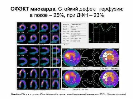 Офэкт кт