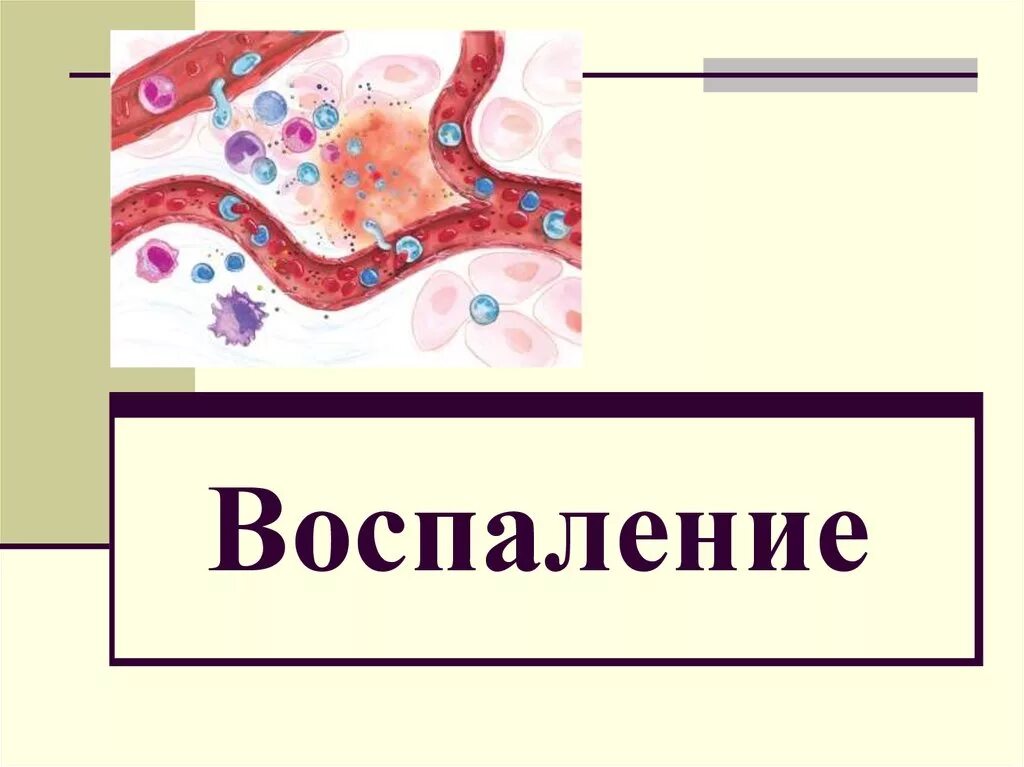 Чем грозит воспаление. Воспаление презентация. Воспалкнип.