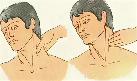 Измерение пульса на сонной артерии. Сонная артерия справа или слева. Правая общая сонная артерия наружная. Сонная артерия и яремная вена. Где находится сонная артель.