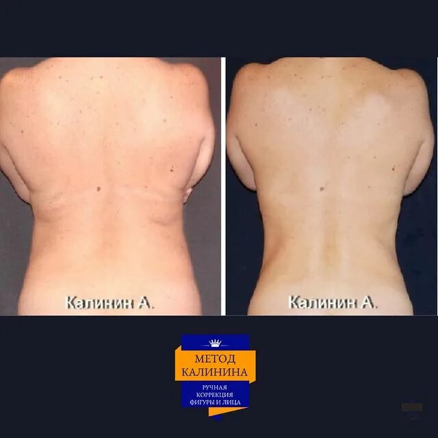 ручную пластику тела