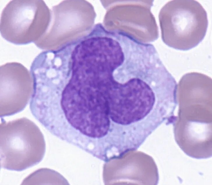 Клетка моноцит. Мононуклеарные фагоциты. Моноциты в микроскопе. Моноциты в микроскопе. Моноциты микроскопия.