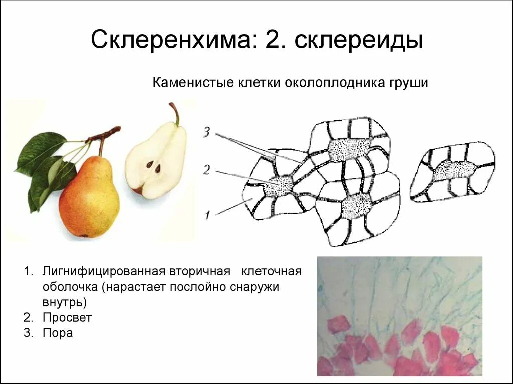 Склереиды каменистые клетки груши. Механическая ткань растений склеренхима. Склереиды в мякоти груши. Механические ткани склереиды груши.