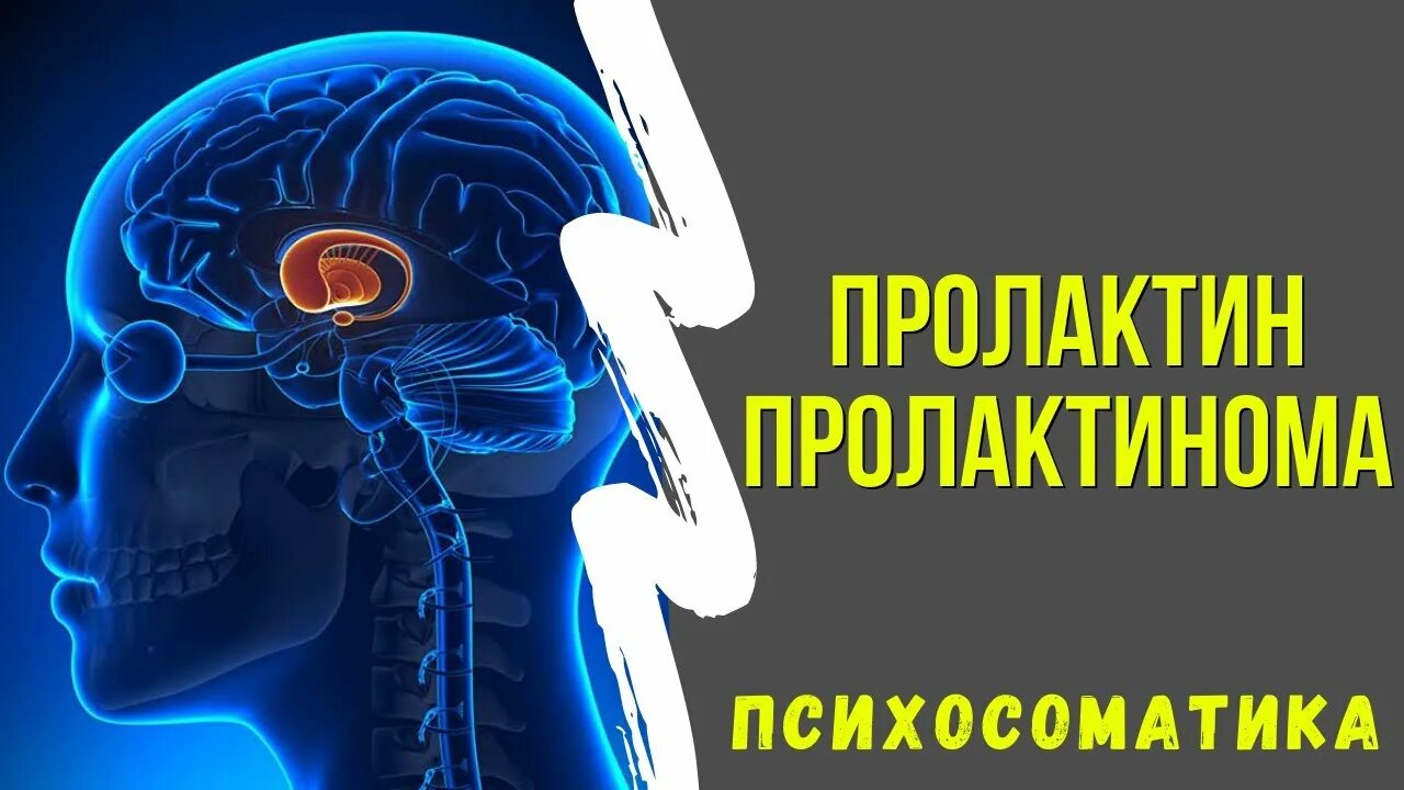 Пролактинома психосоматика. Пролактин психосоматика. Психосоматика повышенного пролактина. Аденома гипофиза психосоматика. Мрт при повышенном пролактине