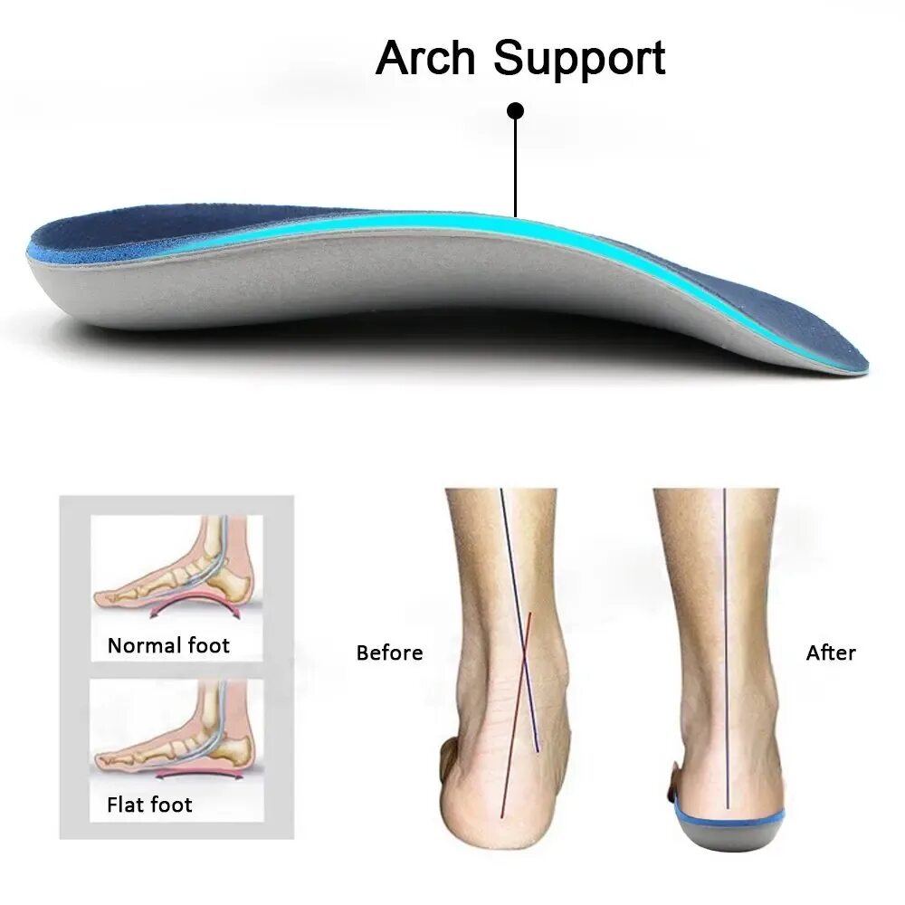 Нужен ли супинатор в обуви. Стельки супинатор 11 p. Ортопедические стельки Activ Arch support so-m12-14. Супинатор в детской обуви. Супинатор в ботинках.