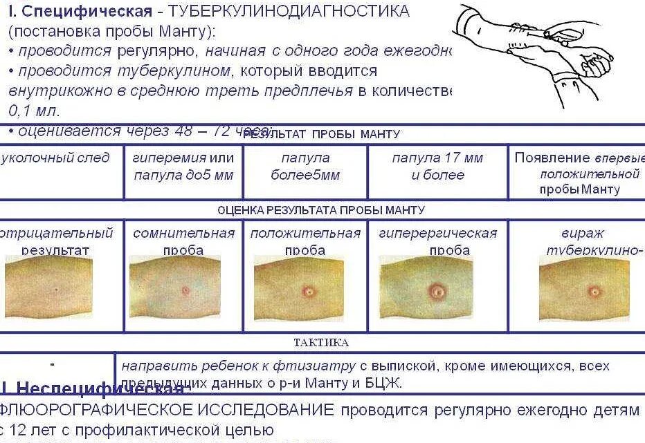 Манту размеры норма 6. Реакция манту норма размера папулы в год. расшифровка реакции манту у ребенка 1 годик. как выглядит нормальная реакция манту у ребенка 5 лет. ложноположительная реакция манту у ребенка 1год.