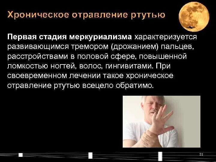 Меркуриализм