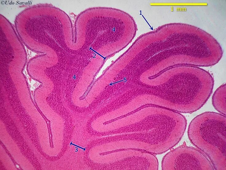 Ткань мозжечка. Мозжечок гистология. Клетки мозжечка гистология. Мозжечок гистологический препарат.