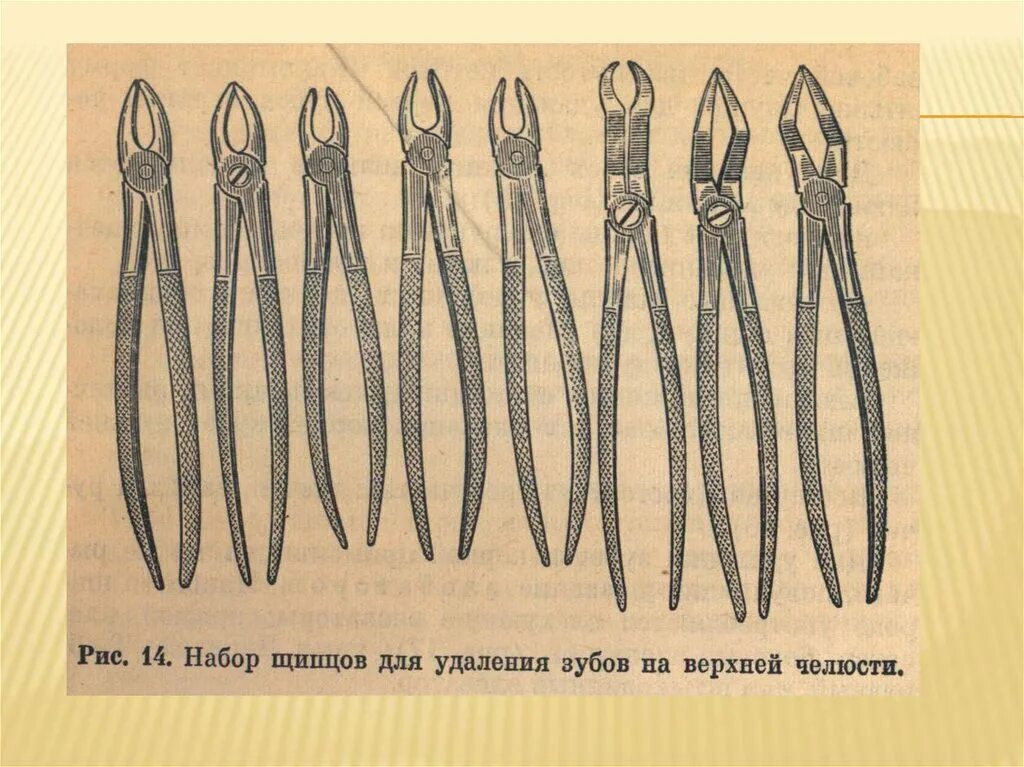 Какими инструментами вырывают зубы