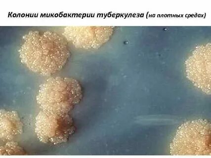 Среда для микобактерий туберкулеза