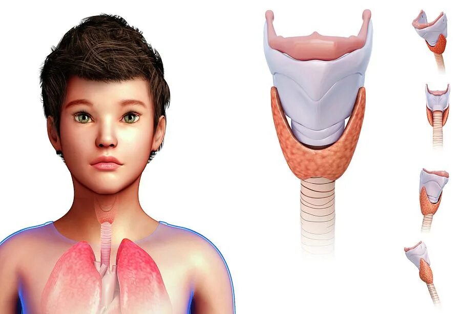 щитовидная железа базедова болезнь. тиреотоксикоз с диффузным зобом. первичный гипотиреоз у детей. клинические проявления гипотиреоза у детей. щитовидная железа симптомы заболевания у женщин гипотиреоз.