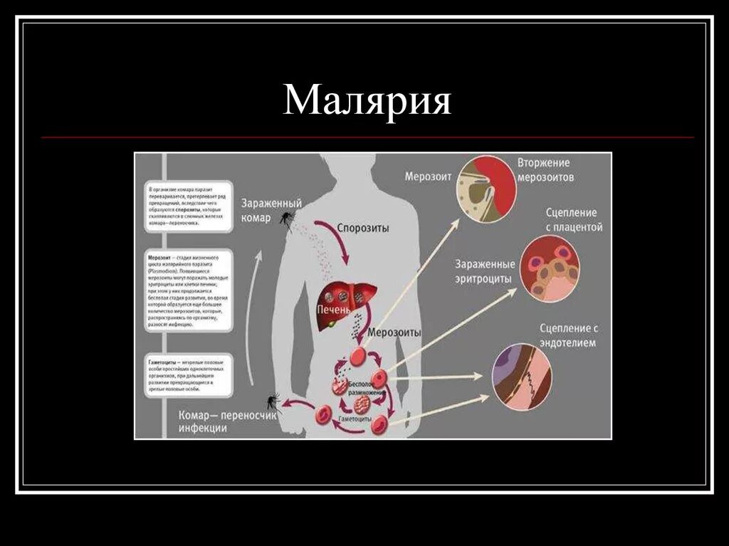 Заражение человека малярией происходит. Малярия органы поражения. Инфекционные заболевания малярия.