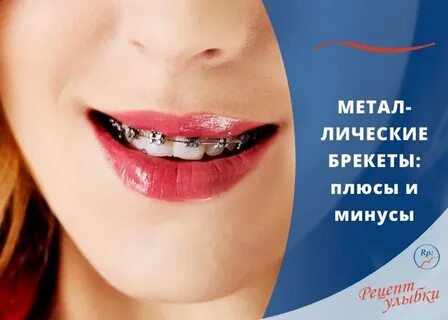 Рецепт улыбки
