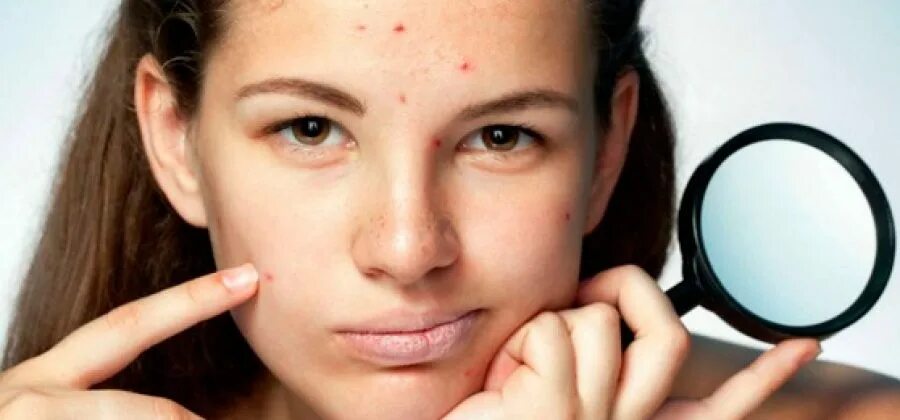Problem skin. Problem skin