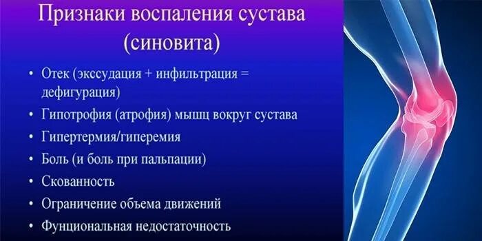 Как лечить синовит коленного сустава. Жидкость в коленном суставе синовит. симптомы хронического синовита коленного сустава. выпотной синовит коленного сустава. синовит коленного сустава рентген.