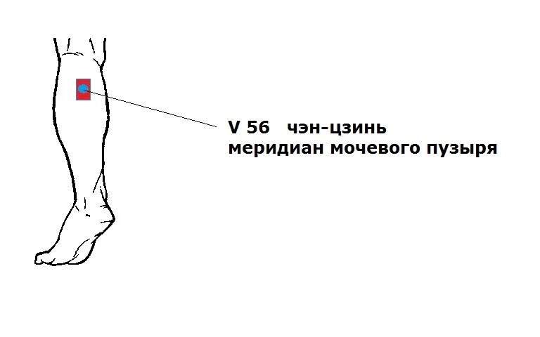 Ночью сильно свело икру ноги. Парез икроножной мышцы. Мышечный спазм в икроножной мышце. Свело икроножную мышцу.