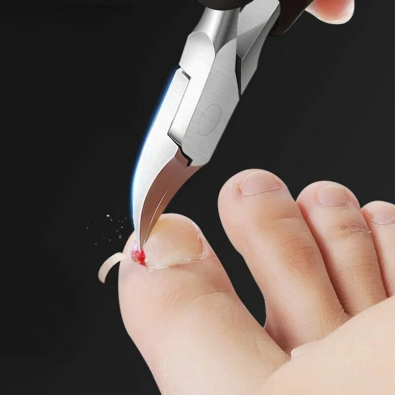 Сколько стоит подстричь ногти. Ножницы стричь ногти на ногах. Ножницы для вросших ногтей на ногах. Подстригают ноготь ножницами.