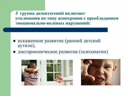 Дизонтогения