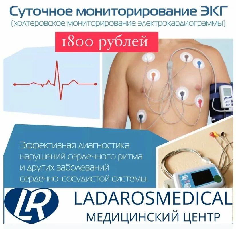 Хм мониторирования. Хм мониторирования