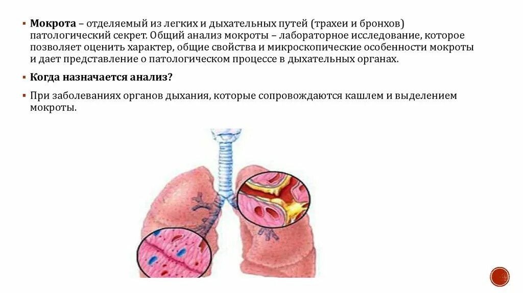 Примеси в мокроте. Мокрота при туберкулезе легких.