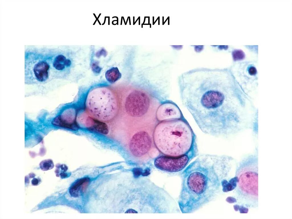 Хламидии трихомонады микоплазма. Хламидиоз Романовскому-Гимзе. Хламидии Романовскому Гимзе. Хламидии микробиология. Патогенные хламидии микробиология.