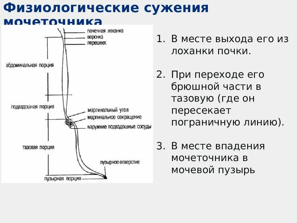 Название мочеточника. Физиологические сужения мочеточника. Места физиологических сужений мочеточника. 3 Физиологических сужения мочеточника. Физиологические сужения мочеточника у женщин.